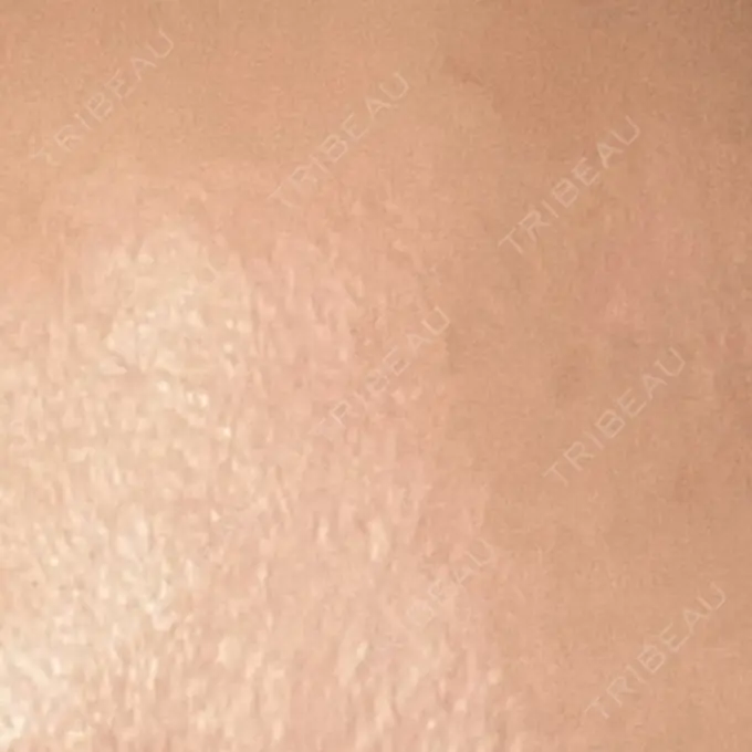 プラセンタ注射 吉祥寺アイビークリニック DAY 8 メイン用