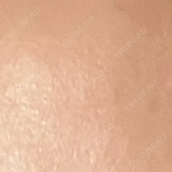 プラセンタ注射 吉祥寺アイビークリニック DAY 5 メイン用