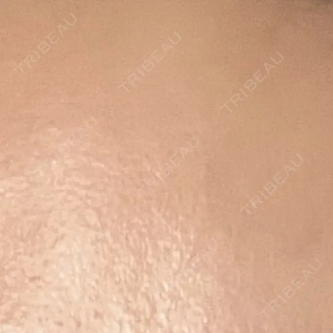 プラセンタ注射 吉祥寺アイビークリニック DAY 7 メイン用