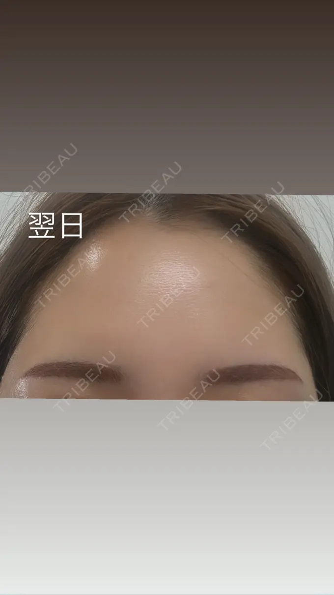 アートメイク（眉） メディカルアートメイク大阪 AFTER メイン用
