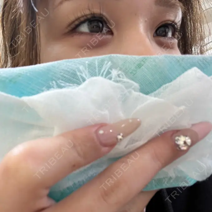 ヒアルロン酸注入（涙袋） / ヒアルロン酸注入（唇） 共立美容外科 京都院 AFTER メイン用