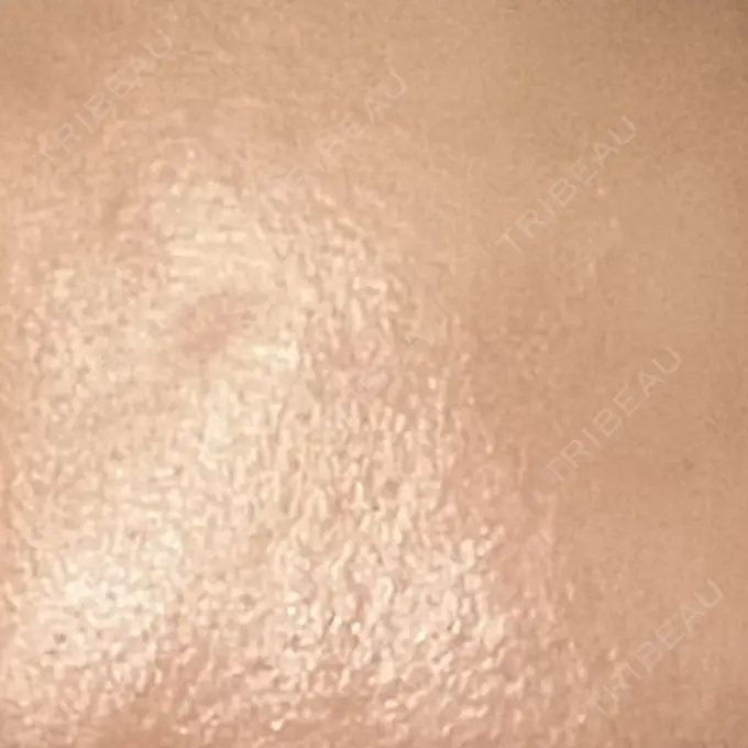 プラセンタ注射 新宿駅三丁目クリニック AFTER メイン用