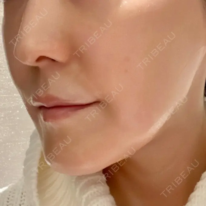 デンシティ First Clinic DAY 0 メイン用