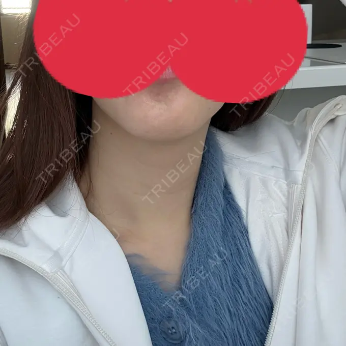 アグネス 日本美容・医療クリニック 六本木院 DAY 6 メイン用