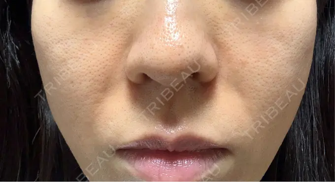 ジャルプロ 城本クリニック 静岡院 AFTER メイン用