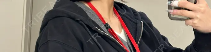 ボトックス（肩） メディカルアルファクリニック DAY 3 メイン用