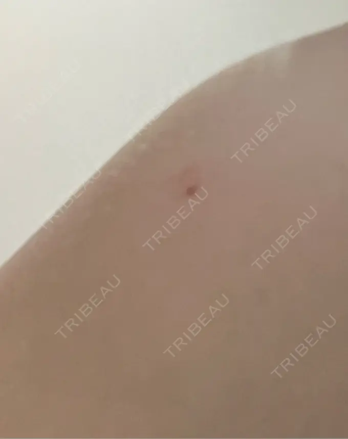 プラセンタ注射 吉祥寺アイビークリニック AFTER メイン用