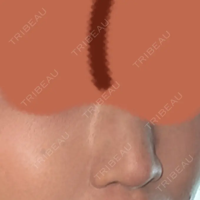 ルメッカ ルラ美容クリニック 名古屋栄院 / ルラスキンクリニック 名古屋栄院 DAY 16 メイン用