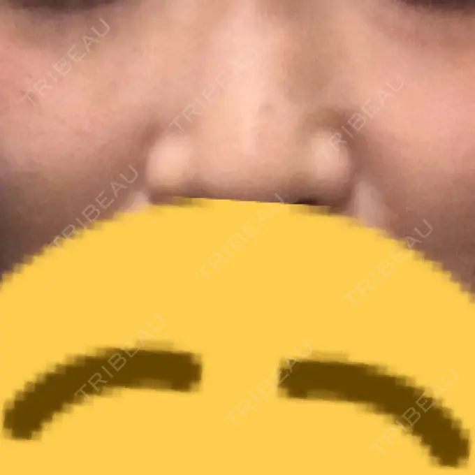 ルメッカ ルラ美容クリニック 名古屋栄院 / ルラスキンクリニック 名古屋栄院 DAY 9 メイン用