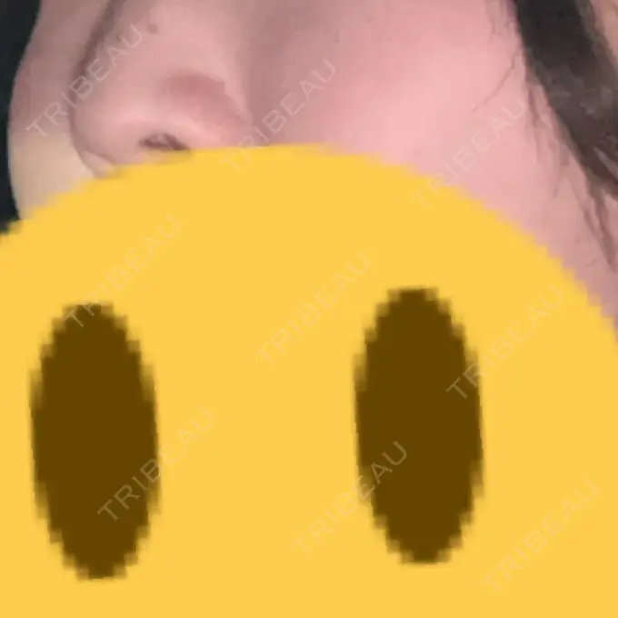 ルメッカ ルラ美容クリニック 名古屋栄院 / ルラスキンクリニック 名古屋栄院 DAY 12 メイン用