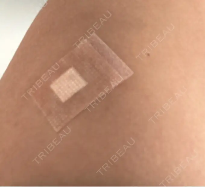 プラセンタ注射 美容皮膚科エルムクリニック 麻布院 AFTER メイン用