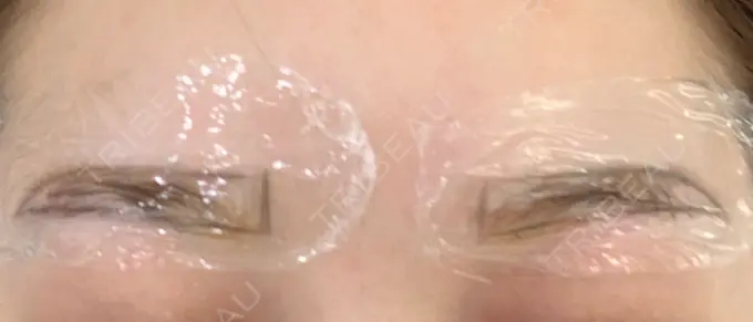 アートメイク（眉） QT整形外科(アートメイクセンター) DAY 0 メイン用