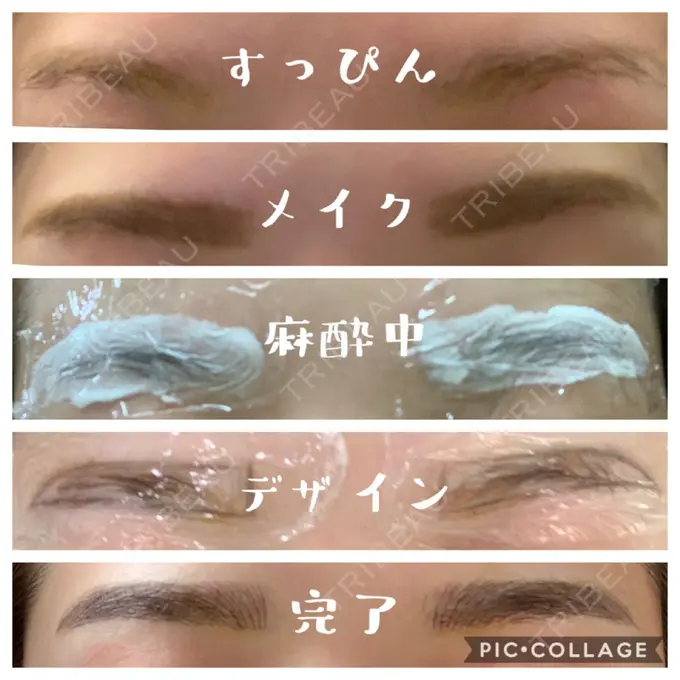 アートメイク（眉） QT整形外科(アートメイクセンター) DAY 7 メイン用