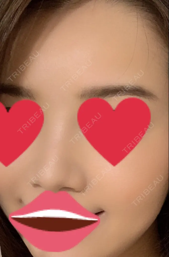 アートメイク（眉） QT整形外科(アートメイクセンター) AFTER メイン用