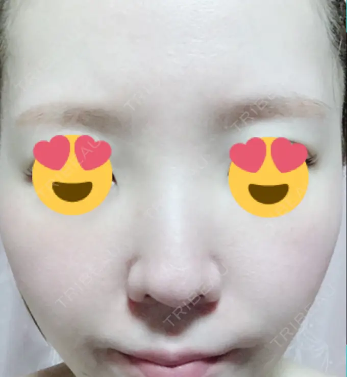 その他（肌） / 美肌レーザー みやた形成外科・皮ふクリニック AFTER メイン用