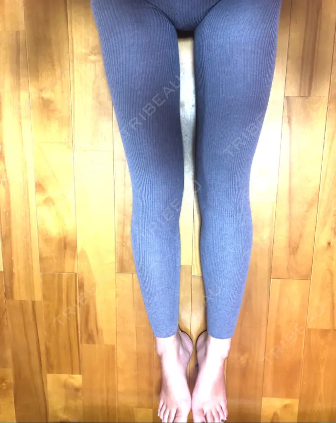 脂肪吸引（脚） THE CLINIC（ザ・クリニック） 名古屋院 DAY 63 メイン用