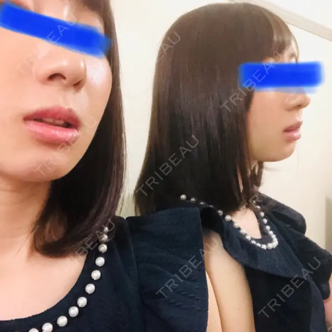 セットバック カトレア歯科・美容クリニック DAY 16 メイン用