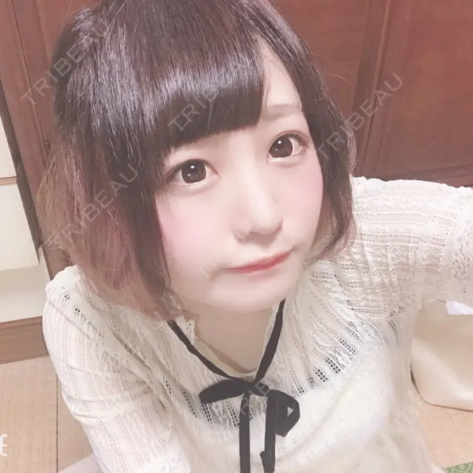 隆鼻術 / 鼻中隔延長（切開） / 鼻孔縁挙上 プリモ麻布十番クリニック AFTER メイン用