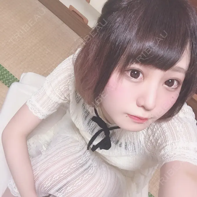 隆鼻術 / 鼻中隔延長（切開） / 鼻孔縁挙上 プリモ麻布十番クリニック DAY 114 メイン用