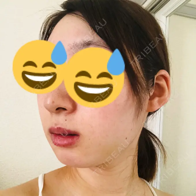 セットバック カトレア歯科・美容クリニック DAY 23 メイン用