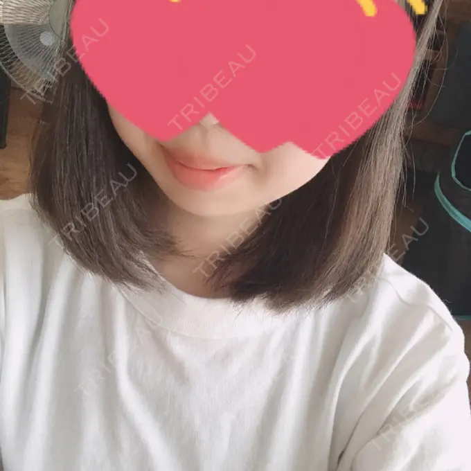 ボトックス（あご） 恵聖会クリニック 京橋院 DAY 4 メイン用