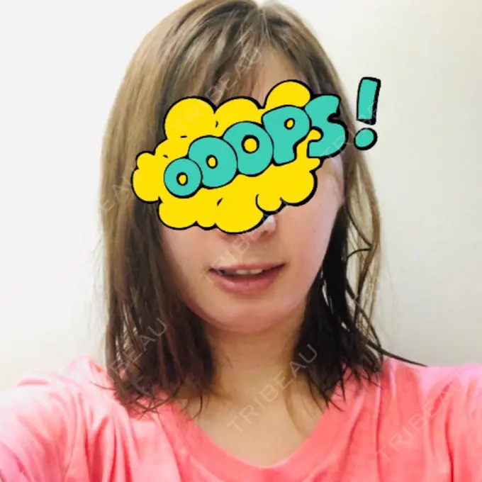 セットバック カトレア歯科・美容クリニック DAY 27 メイン用