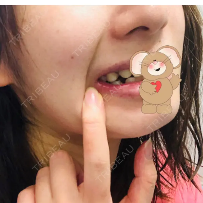 セットバック カトレア歯科・美容クリニック DAY 27 メイン用