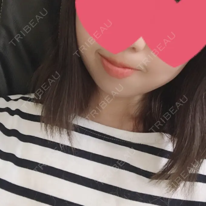 ボトックス（あご） 恵聖会クリニック 京橋院 DAY 5 メイン用