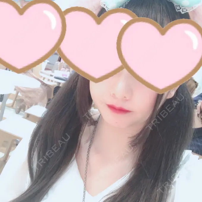 セットバック 大塚美容形成外科・歯科 大塚本院 DAY 19 メイン用