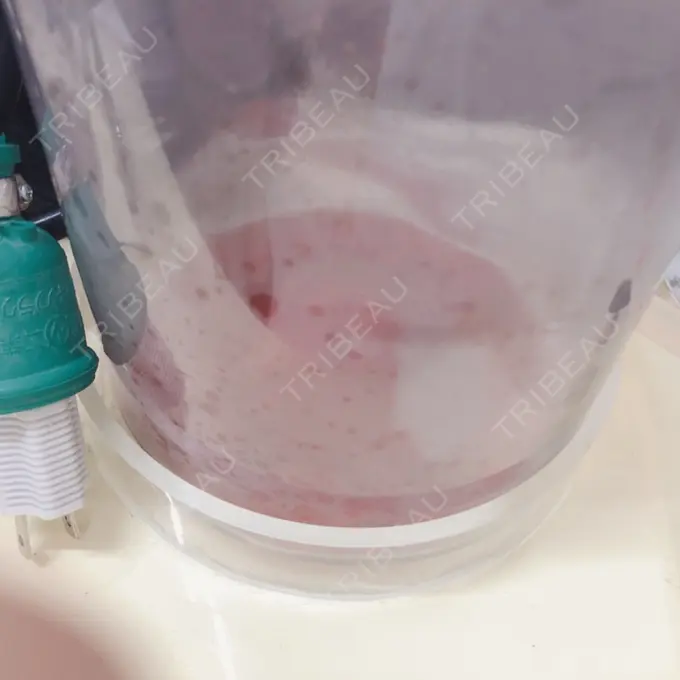 二重埋没 / 糸リフト / 脂肪吸引（顔） / ボトックス（あご） / ヒアルロン酸注入（あご） TCB東京中央美容外科 新宿東口院 DAY 2 メイン用