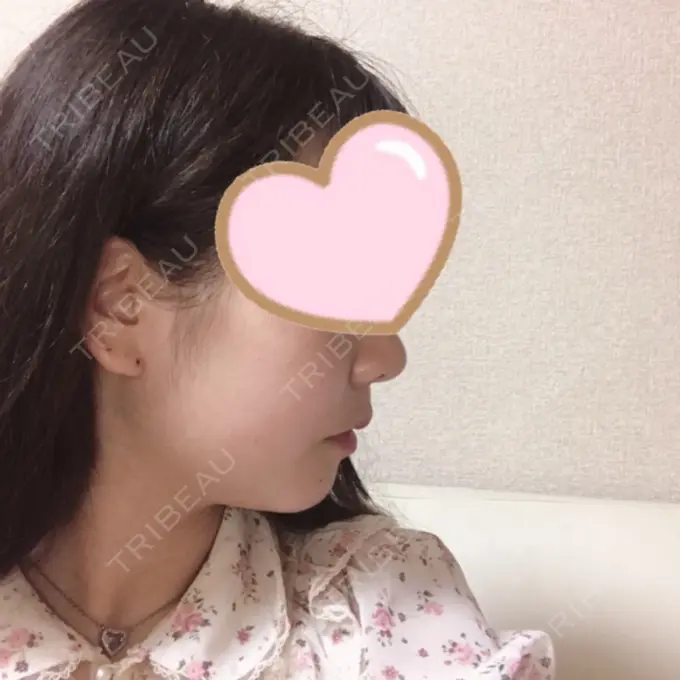 セットバック 大塚美容形成外科・歯科 大塚本院 AFTER メイン用