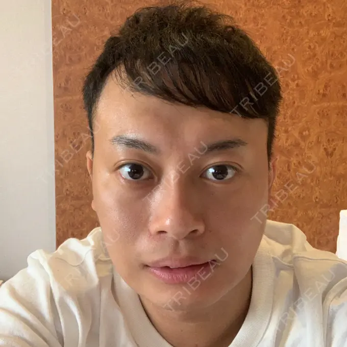 その他（輪郭） スタート整形外科 DAY 1 メイン用