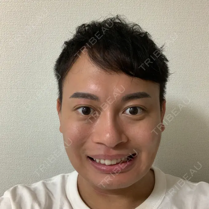 その他（輪郭） スタート整形外科 DAY 7 メイン用