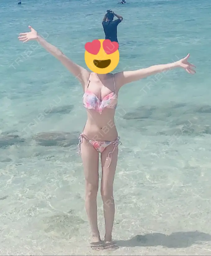 豊胸（脂肪注入） 広島プルミエクリニック AFTER メイン用