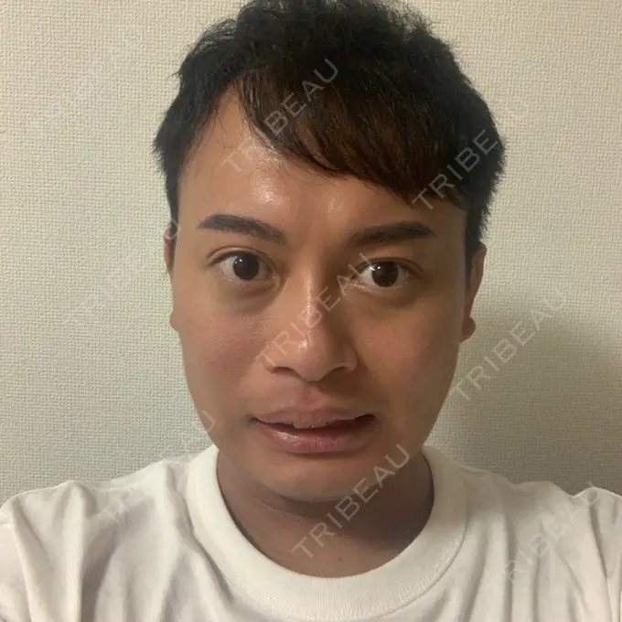 その他（輪郭） スタート整形外科 DAY 15 メイン用