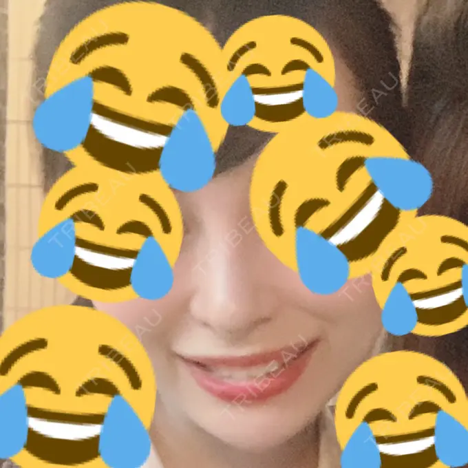 鼻尖形成（切開） / 小鼻縮小（切開） / 軟骨移植 / 骨切幅寄せ / ワシ鼻修正・ハンプ切除 FROM B整形外科 (旧バウム整形外科) DAY 30 メイン用