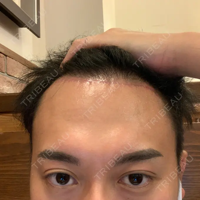 その他（輪郭） スタート整形外科 DAY 34 メイン用