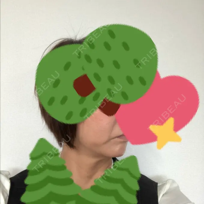 糸リフト / バッカルファット除去 / 肌ヒアルロン酸注入（たるみ・シワ改善） 大阪TAクリニック DAY 37 メイン用