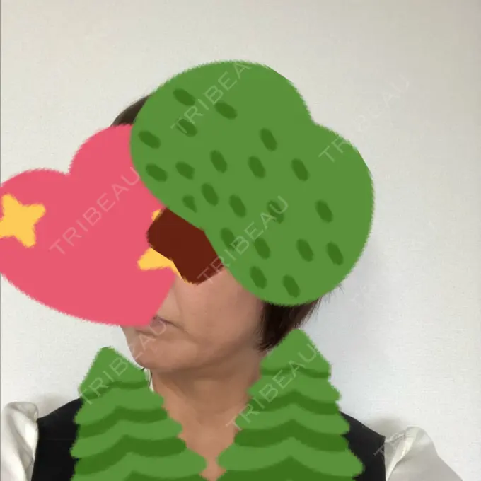 糸リフト / バッカルファット除去 / 肌ヒアルロン酸注入（たるみ・シワ改善） 大阪TAクリニック DAY 37 メイン用