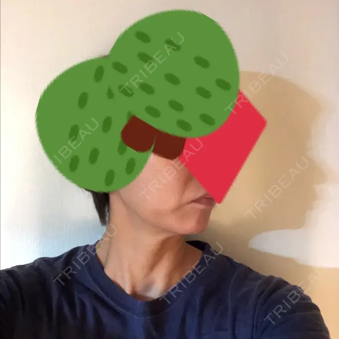 糸リフト / バッカルファット除去 / 肌ヒアルロン酸注入（たるみ・シワ改善） 大阪TAクリニック DAY 40 メイン用