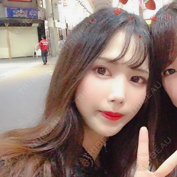 二重埋没 / 骨切り（あご） / 骨削り（頬） / 軟骨移植 / 骨切幅寄せ バノバギ整形外科 DAY 311 メイン用