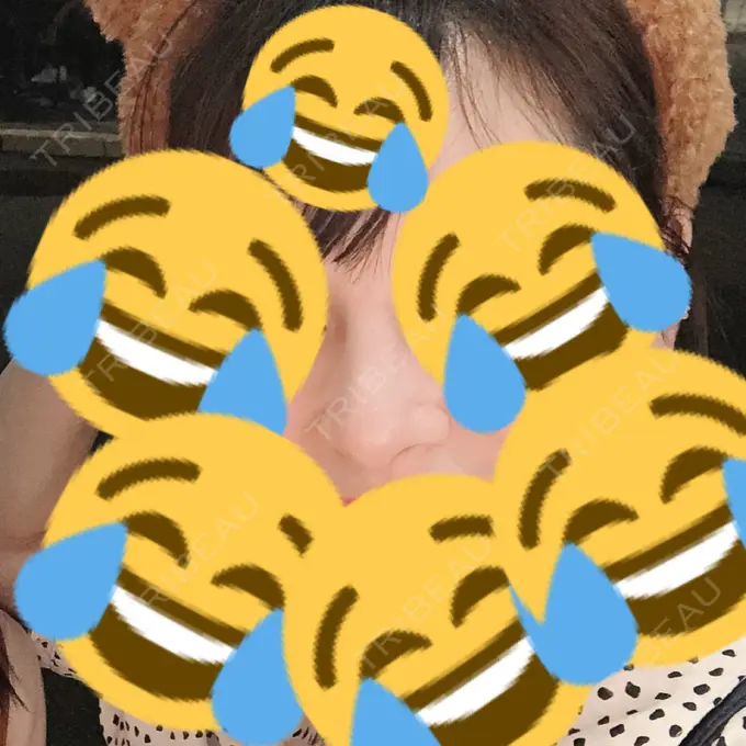 鼻尖形成（切開） / 小鼻縮小（切開） / 軟骨移植 / 骨切幅寄せ / ワシ鼻修正・ハンプ切除 FROM B整形外科 (旧バウム整形外科) DAY 56 メイン用