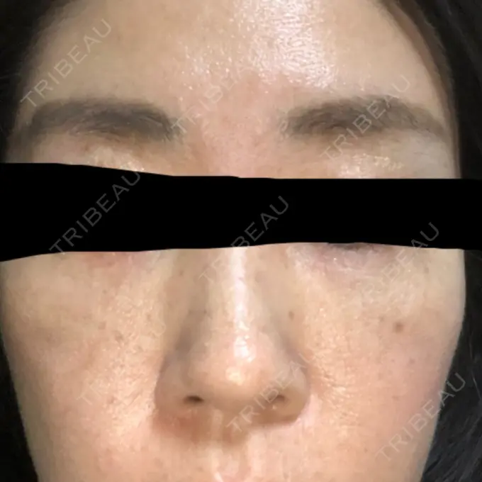 再生医療 RDクリニック大阪 AFTER メイン用