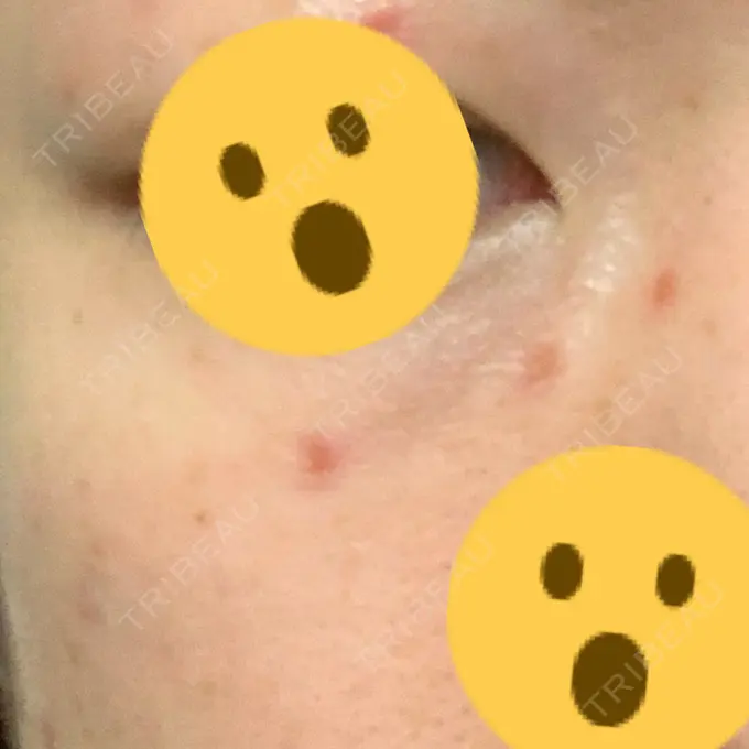 ほくろ・いぼ切除（肌） 医療法人美彩会 グランクリニック DAY 3 メイン用