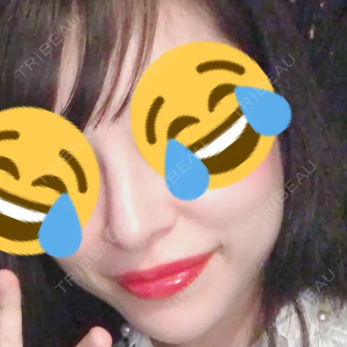 鼻尖形成（切開） / 小鼻縮小（切開） / 軟骨移植 / 骨切幅寄せ / ワシ鼻修正・ハンプ切除 FROM B整形外科 (旧バウム整形外科) DAY 87 メイン用