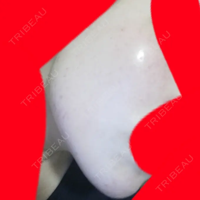 美肌レーザー / シミ取りレーザー / ルビーレーザー 銀座お肌の診療所 DAY 6 メイン用