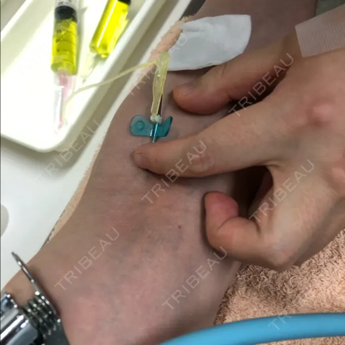 その他 秋葉原スキンクリニック AFTER メイン用