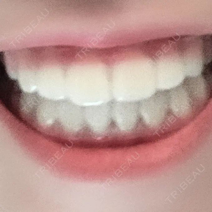 矯正（ワイヤー） ランバート矯正歯科 DAY 594 メイン用