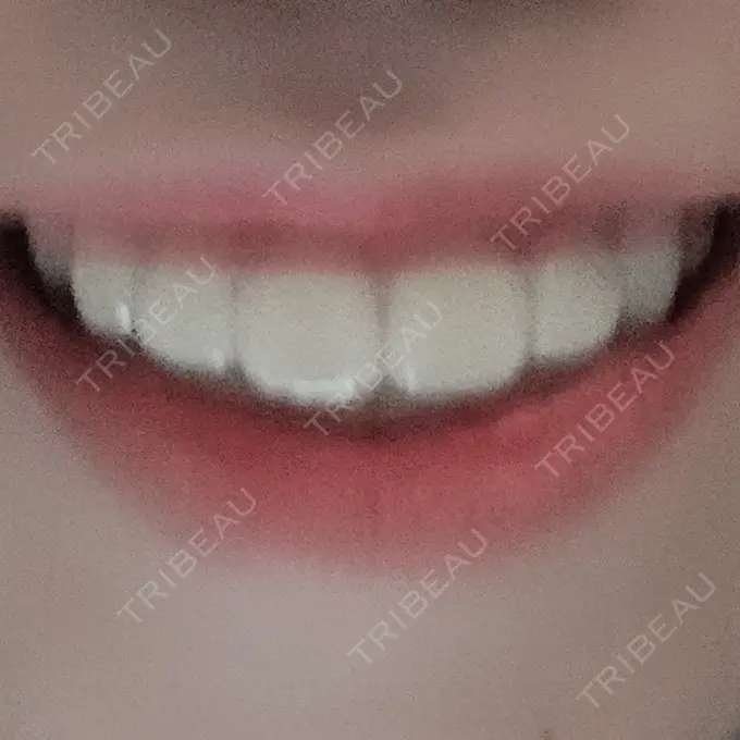 矯正（ワイヤー） ランバート矯正歯科 DAY 594 メイン用