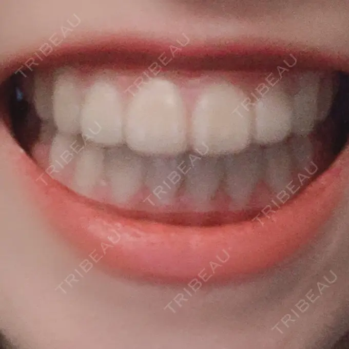 矯正（ワイヤー） ランバート矯正歯科 DAY 600 メイン用